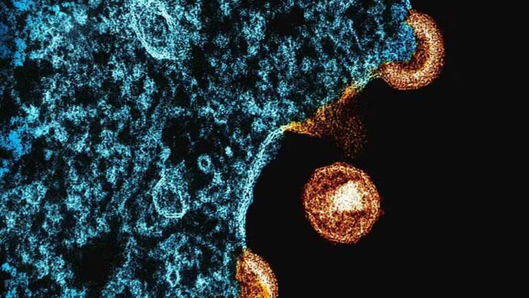 Chave para a cura do HIV pode ser a mesma usada nas vacinas de mRNA, aponta estudo pioneiro divulgado pelo G1