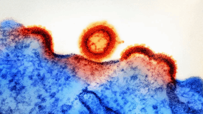 O Globo: Estudo revela em que partes do corpo o HIV se esconde, abrindo caminho para novos tratamentos