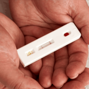 Iniciativa do Ministério da Saúde abordará a evolução do diagnóstico de HIV