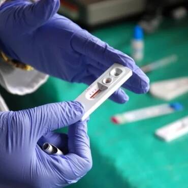 G1: ‘Pior do que viver com HIV é não saber que vive com o vírus’, alerta infectologista