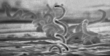 Estudo sobre antibiótico como prevenção de ISTs bacterianas está em fase de recrutamento, divulga Jornal da USP