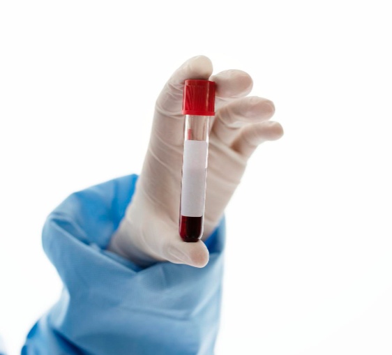 Especialistas publicam primeiras recomendações internacionais para orientar manejo da viremia de baixo nível no HIV